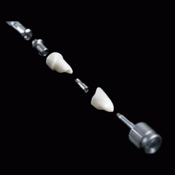 Implant-Based Restoration Warranty Program by Aurum Ceramic Dental Laboratories LLP