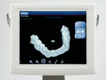 Figure 6  The virtual model enables easy viewing of the occlusal clearance between the preparation and the opposing teeth, including the difficult-toview lingual cusps.