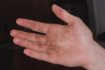 Figure 5 Because alcohol hand rubs do not remove bioburden from contaminated hands,
visibly soiled hands must be washed