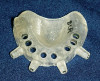 Figure 22 After cementation, the eight provisionalized teeth were scanned.