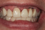 Figure 1 Patient's smile line is assessed for tooth size, shape, and color.