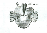Figure 1 Delabarre’s obturator, velum, and uvula restored with elastic gum. (Taken from: Aramany MA. A history of prosthetic management of cleft palate: Pare′ to Suersen. Cleft Palate J. 1971;8:415-430.)
