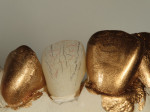 Figure 28 Gold die spacer painted
over adjacent teeth shows texture
definition of surrounding dentition.