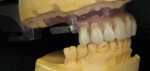Figure 14 Right lateral view of tooth arrangement.