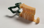 Figure 10 A printed dental model with a nonremovable die.