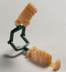 Figure 11 A dental model printed with VeroDentPlus material.