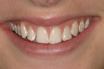 Figure 1  The patient´s preoperative smile.