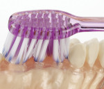 Figure 2. Brush head comprising extremely tapered bristles demonstrating the ability to reach deep into the gingival sulcus.