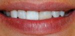 Figure 5. Additional view of the patient’s dentition prior to shade mapping.