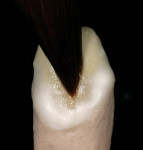 Figure 5  Captek with VM13 effect liner isapplied at margins and a thin layer over the core.
