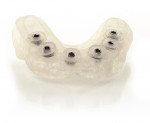 Figure 4  SimPlant® by Materialise Dental is a CT-based implant treatment planningsoftware system that will revolutionize any implant practice.
