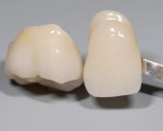 Fig 9 and Fig 10. Follow Argen Digital’s recommended Zirconia sintering instructions.
