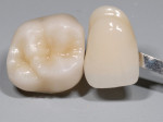Fig 9 and Fig 10. Follow Argen Digital’s recommended Zirconia sintering instructions.