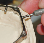 Fig 3. Ball screws are inserted.