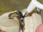 Fig 6. Bonding cement is used to bond the ball screws into the implant bar.