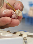 Fig 2. Ceramist putting the final touches on a full contour zirconia crown.