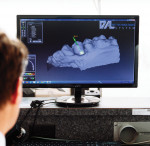 Fig 2 and Fig 3. Ryan Johnson designs a model using exocad® DentalCAD software.