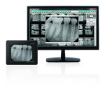 DEXIS imaging software are offered in PC, MAC, and app platforms.
