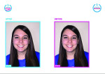 Before-and-after photos in Romexis Smile Design Software from Planmeca