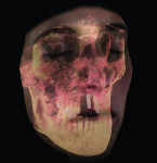 Figure 19 GALILEOS FaceScanner.