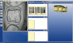 Figure 6  Optical images of the crown preparation recorded to the CEREC 3D software.