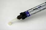 Figure 11  Automixed dual-cure composite resin luting agent (Bifix QM) injected into the crown.