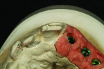 Fig 3. Occlusal view.