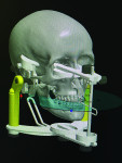 The file was converted into STL format for medical modeling so that Culp could import it into his CAD software for prosthetic design.