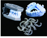 Fig 1. Printed models and surgical guides from In'Tech Industries, Incorporated, which provides outsourcing services.