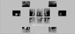 Fig 1. Full-mouth x-rays at the initial visit.