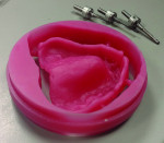 Fig 3. Denture bases can be milled using a laboratory's existing equipment.