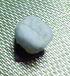 Fig 1. Leaving the bite opening of the wet porcelain buildup open 1/2 mm in the anterior before carving in the basic anatomy when using Stax Plus.