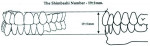 Fig 2. The Shimbashi Number is used to measure ideal mandibular restoration.
