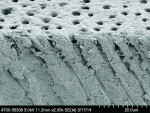 Fig 9. SEM image of the dentin section treated with the oxalate strip (three product applications). Crystal deposition occurs inside the tubuli, beneath the dentin surface.
