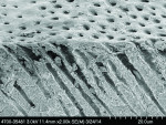 Fig 10. SEM image of the dentin section treated with the oxalate rinse (three product applications). Average crystal diameter is reduced compared to that produced by the strip.