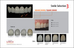 Figure 6  Sample smile selection chart acts as a guide for choosing shape, texture, and color.