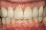 Figure 12  Natural smile view.