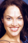 Figure 1  Image of smile where the facial and dental midline do not line up.