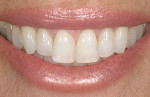 Figure 6  Image of a smile that was rated excellent by several evaluators at the UCLA Center for Esthetic Dentistry.