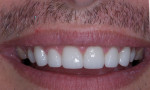 Fig 14. Postoperative close-up view of the patient’s smile.