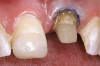 Fig 16. Post-treatment full-mouth radiographs.