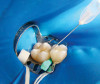 Fig 6. A transitional resin-bonded-retained dental prosthesis was used to replace tooth No. 7.