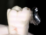 Figure 18  The “extracted” ivorine tooth with the matrix partly peeled away.