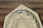 Figure 5  Proposed contour wax-up, incisal view.