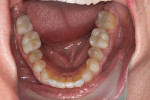 Fig 8. Post-treatment, lower dentition, occlusal view.