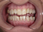 Photograph of patient after completion of treatment.
