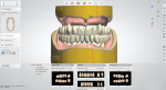 Fig 4. The 3Shape Dental System provides a default setup of the teeth, with tooth libraries provided in the lower screen.
