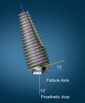 The Co-Axis implant illustrating the off-axis orientation of the platform in relation to
the implant’s long axis.