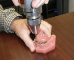 Figure 3  Using a torque gauge to measure abutment removal.