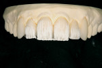 Figure 13  To finish the internal powder effects, Light MM was added to the incisal edge to finalize the halo effect.
